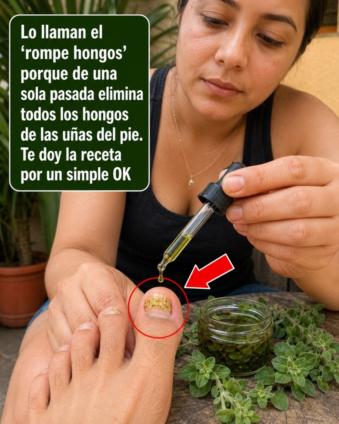 Aplicación de aceite esencial de orégano en las uñas