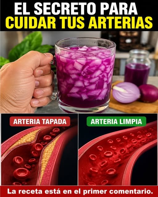Cebolla Morada para limpiar arterias