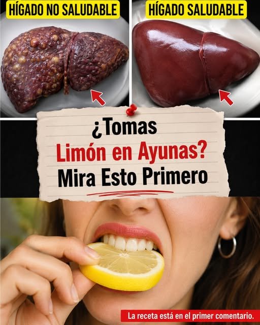 Beneficios del Limón para el Hígado